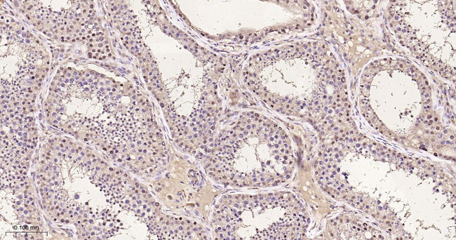 Acetylated Lysine Antibody in Immunohistochemistry (Paraffin) (IHC (P))