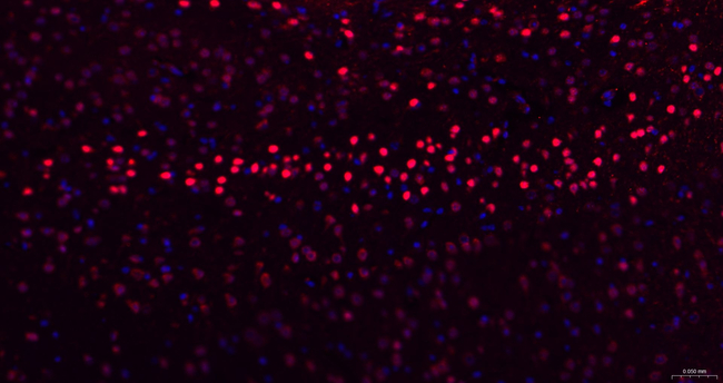 TBR1 Antibody in Immunohistochemistry (Paraffin) (IHC (P))