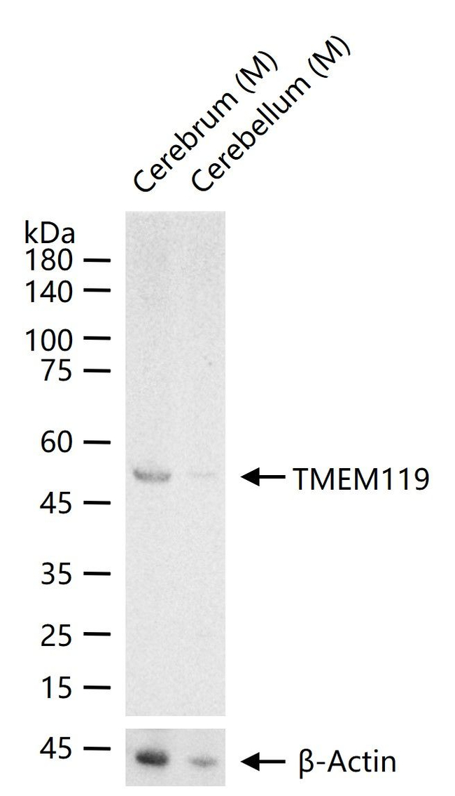 TMEM119 Antibody in Western Blot (WB)
