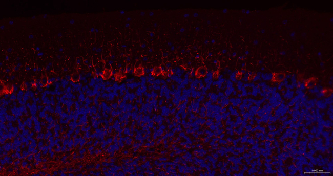 NF-H Antibody in Immunohistochemistry (Paraffin) (IHC (P))
