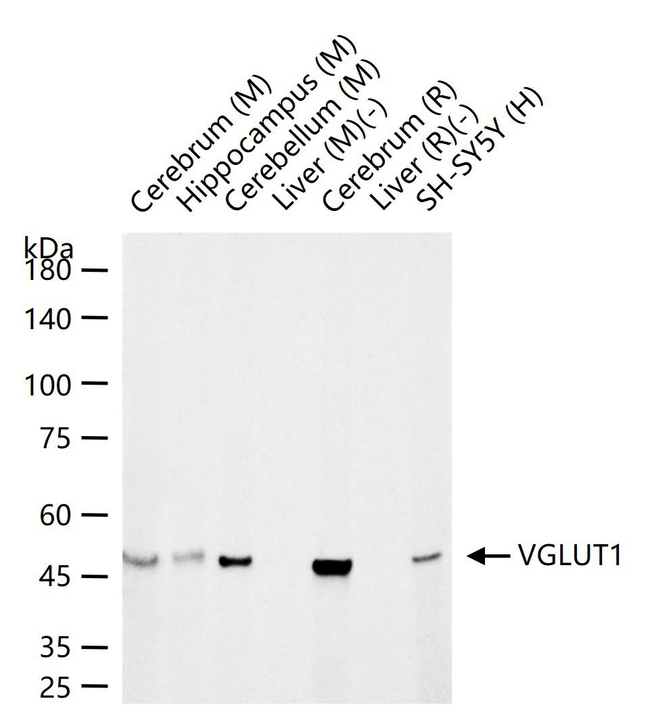 VGLUT1 Antibody in Western Blot (WB)
