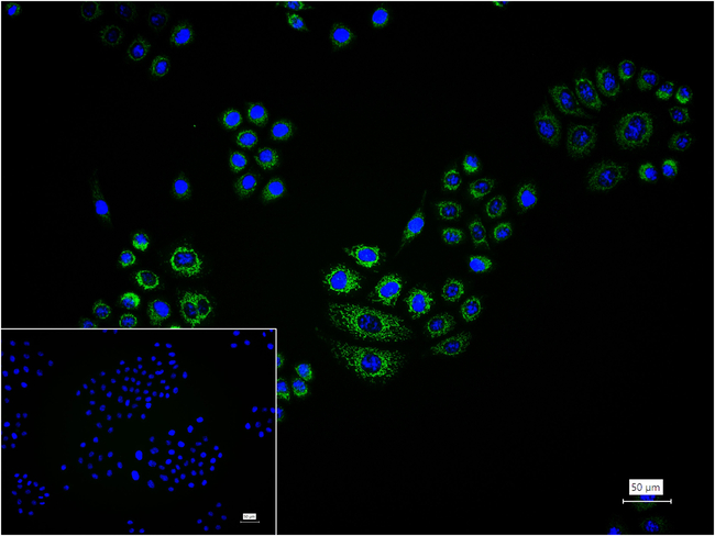 Glutaminase Antibody in Immunocytochemistry (ICC/IF)