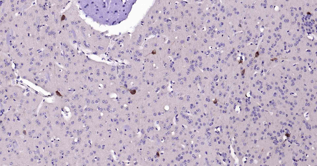 ChAT Antibody in Immunohistochemistry (Paraffin) (IHC (P))