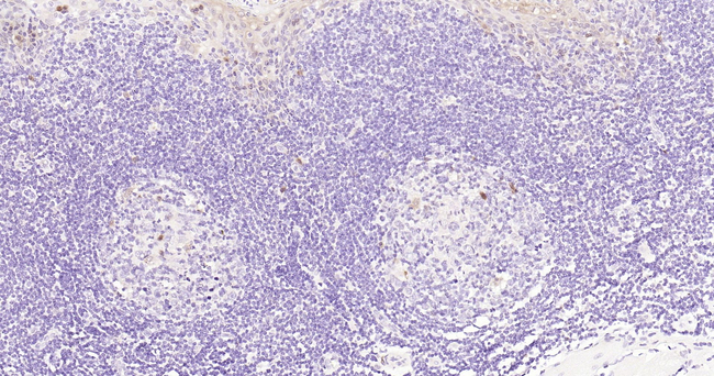 STAT5 alpha Antibody in Immunohistochemistry (Paraffin) (IHC (P))