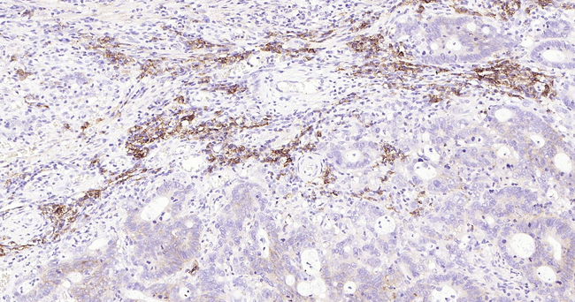 CD138 Antibody in Immunohistochemistry (Paraffin) (IHC (P))