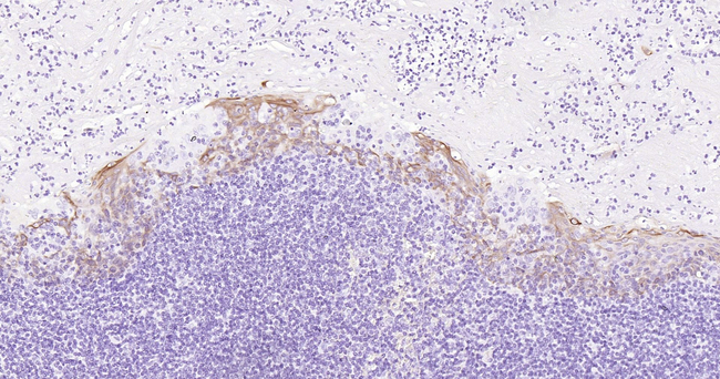 CD1a Antibody in Immunohistochemistry (Paraffin) (IHC (P))