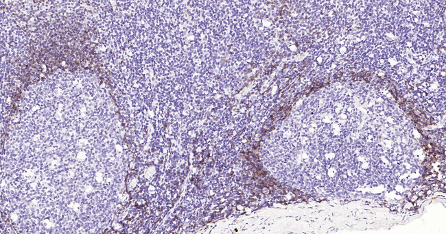 Human IgD Antibody in Immunohistochemistry (Paraffin) (IHC (P))
