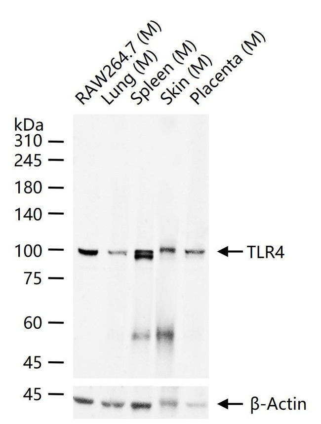 TLR4 Monoclonal Antibody (1G12) (MA572326)
