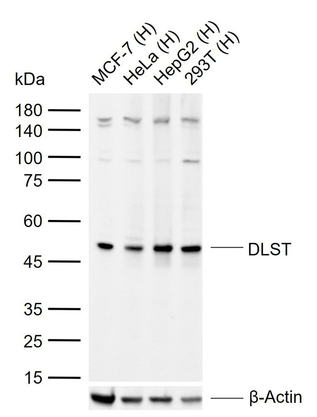 DLST Antibody in Western Blot (WB)