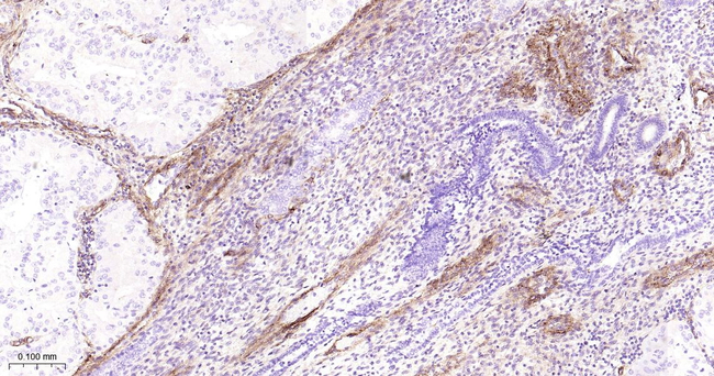 CD90 Antibody in Immunohistochemistry (Paraffin) (IHC (P))