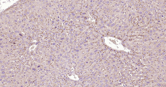 DPP4 Antibody in Immunohistochemistry (Paraffin) (IHC (P))