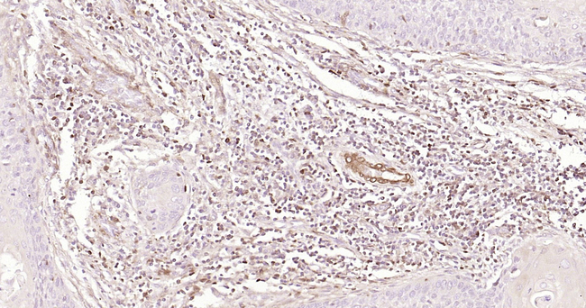 S100A4 Antibody in Immunohistochemistry (Paraffin) (IHC (P))