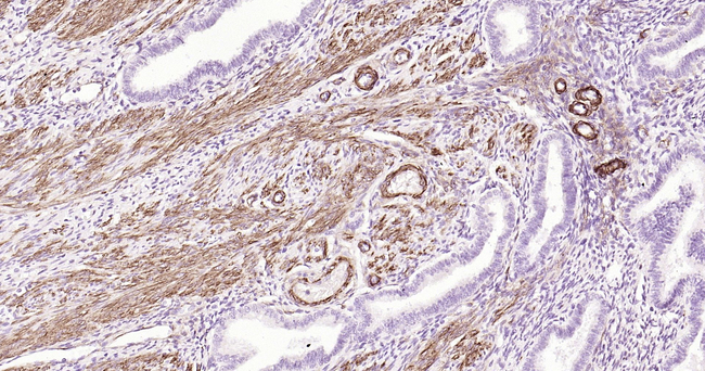 Caldesmon Antibody in Immunohistochemistry (Paraffin) (IHC (P))