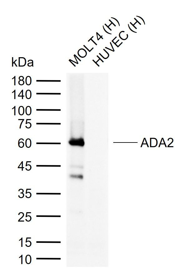 CECR1 Antibody in Western Blot (WB)