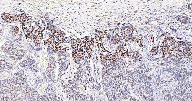 WT1 Antibody in Immunohistochemistry (Paraffin) (IHC (P))