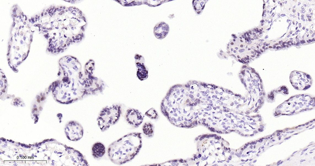 ATF3 Antibody in Immunohistochemistry (Paraffin) (IHC (P))