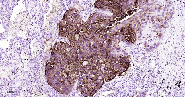 SSEA1 Antibody in Immunohistochemistry (Paraffin) (IHC (P))