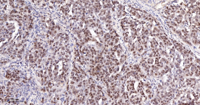 PARP1 (cleaved p25) Antibody in Immunohistochemistry (Paraffin) (IHC (P))