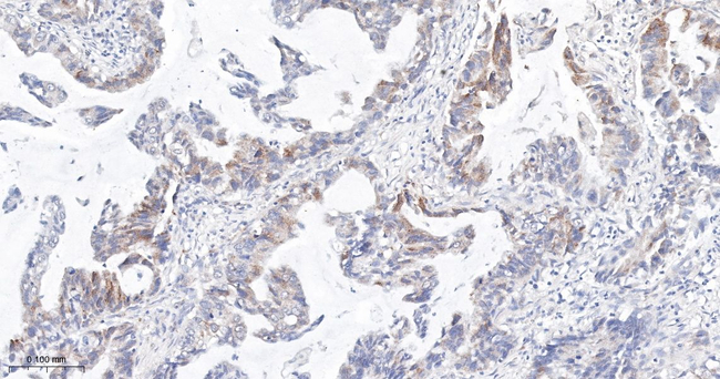 Phospho-S6 (Ser240, Ser244) Antibody in Immunohistochemistry (Paraffin) (IHC (P))