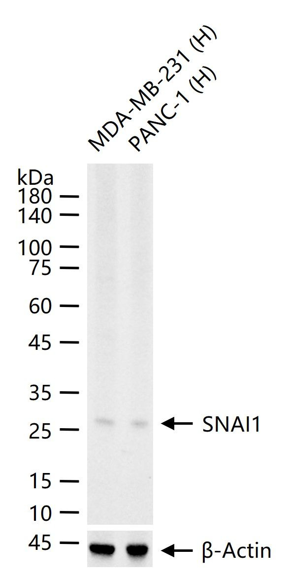 SNAIL Antibody in Western Blot (WB)