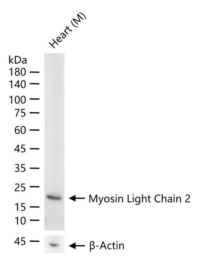 MYL2 Antibody in Western Blot (WB)