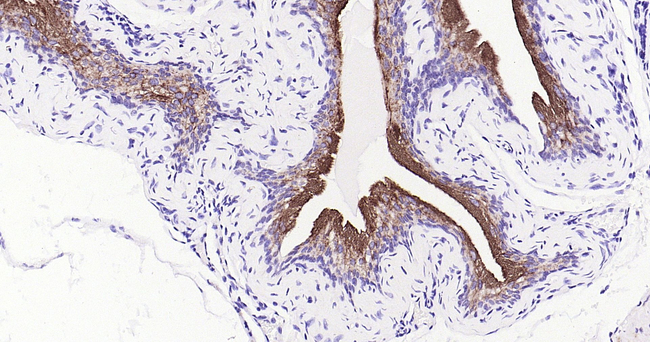 UPK3A Antibody in Immunohistochemistry (Paraffin) (IHC (P))