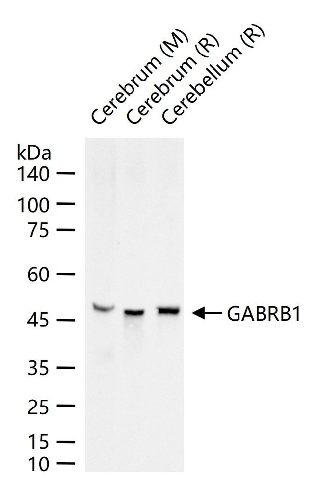GABRB1 Antibody in Western Blot (WB)