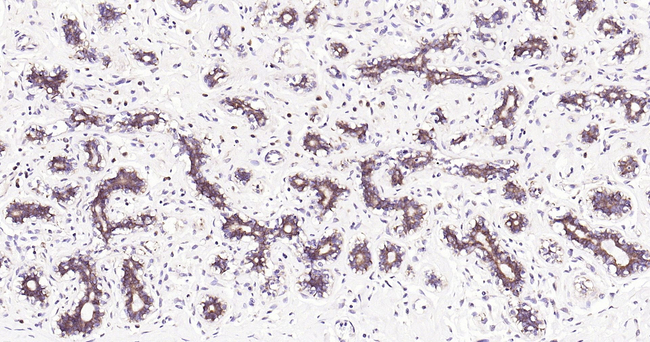 eIF2b epsilon Antibody in Immunohistochemistry (Paraffin) (IHC (P))