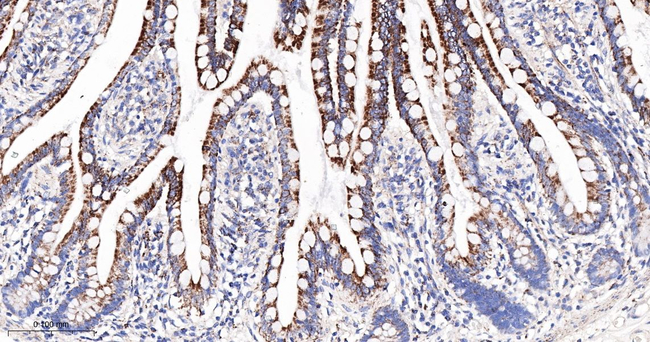 M-CSF Antibody in Immunohistochemistry (Paraffin) (IHC (P))