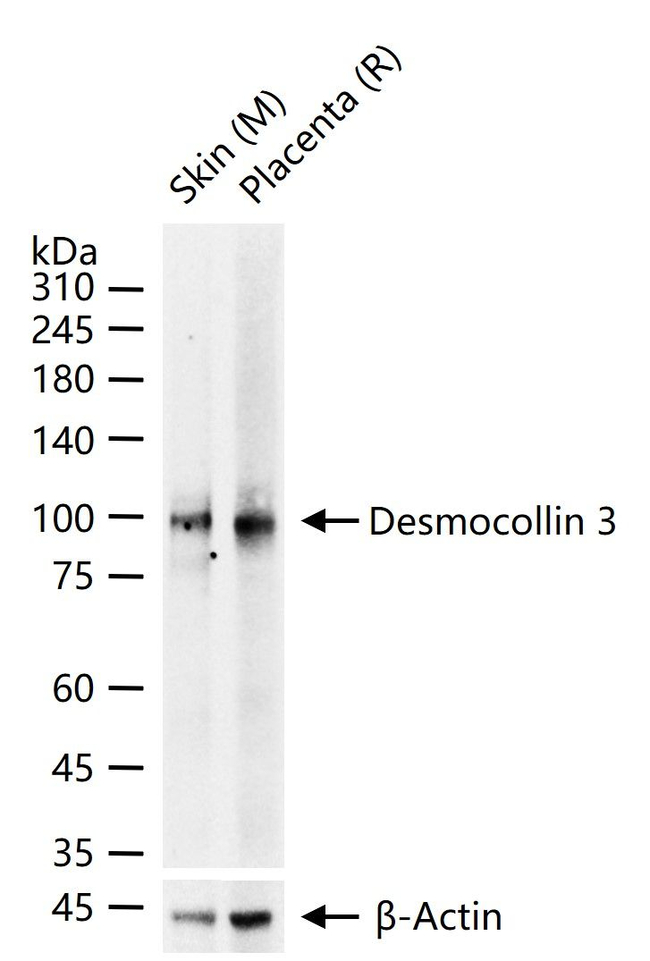 Desmocollin 3 Antibody in Western Blot (WB)