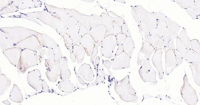 Dystrophin Antibody in Immunohistochemistry (Paraffin) (IHC (P))