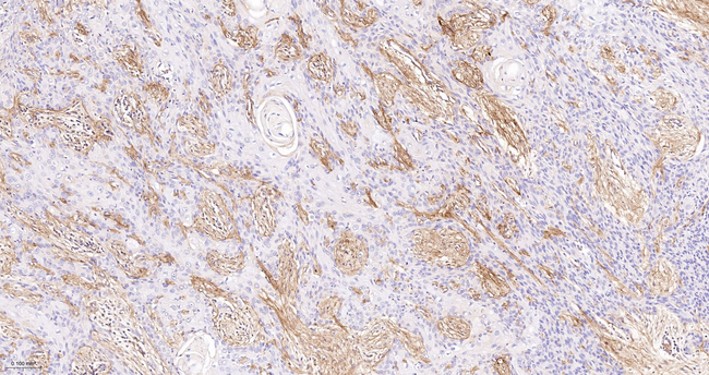 Collagen VI Antibody in Immunohistochemistry (Paraffin) (IHC (P))