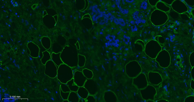 Perilipin 1 Antibody in Immunohistochemistry (Paraffin) (IHC (P))