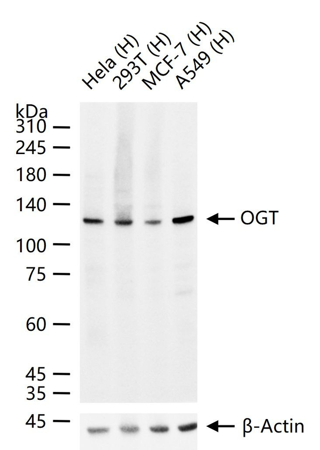 OGT Antibody in Western Blot (WB)