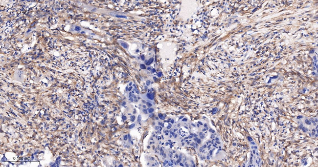 PDGFRB Antibody in Immunohistochemistry (Paraffin) (IHC (P))