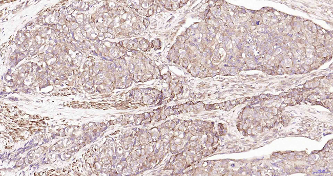 ULK1 Antibody in Immunohistochemistry (Paraffin) (IHC (P))
