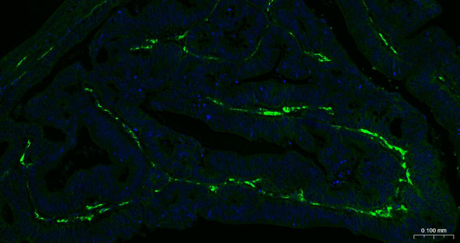 CD105 Antibody in Immunohistochemistry (Paraffin) (IHC (P))