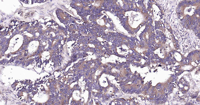 RALA Antibody in Immunohistochemistry (Paraffin) (IHC (P))