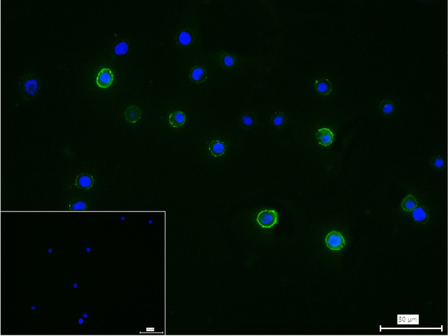BTK Antibody in Immunocytochemistry (ICC/IF)