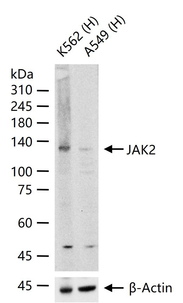 JAK2 Antibody in Western Blot (WB)