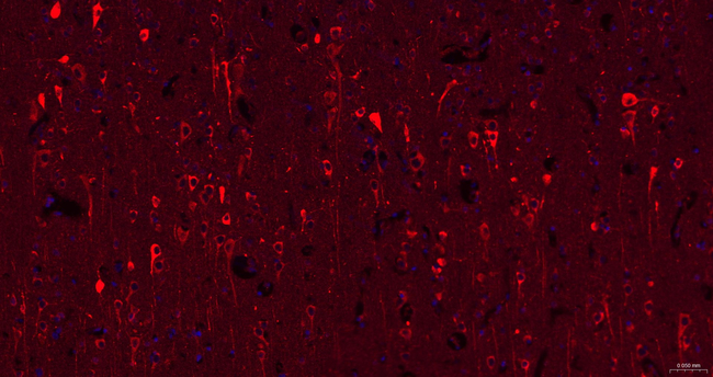 Leptin Receptor Antibody in Immunohistochemistry (Paraffin) (IHC (P))