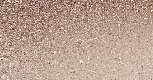 PI3K p55 gamma Antibody in Immunohistochemistry (Paraffin) (IHC (P))