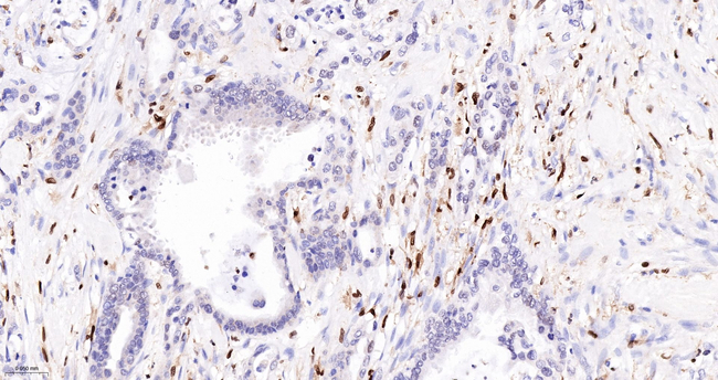 ALOX5 Antibody in Immunohistochemistry (Paraffin) (IHC (P))