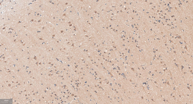 APPL1 Antibody in Immunohistochemistry (Paraffin) (IHC (P))