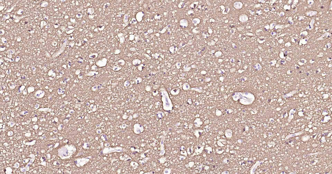 ATP1B1 Antibody in Immunohistochemistry (Paraffin) (IHC (P))
