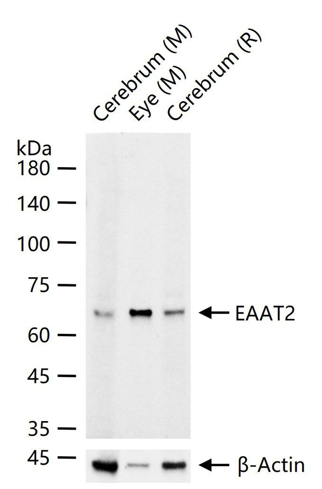 GLT-1 Antibody in Western Blot (WB)