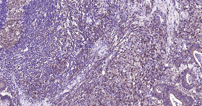 pro-Caspase 3 Antibody in Immunohistochemistry (Paraffin) (IHC (P))