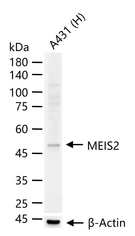 MEIS2 Antibody in Western Blot (WB)