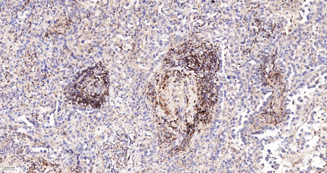 Bcl-2 Antibody in Immunohistochemistry (Paraffin) (IHC (P))