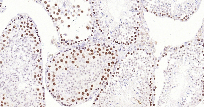 TOP2A Antibody in Immunohistochemistry (Paraffin) (IHC (P))